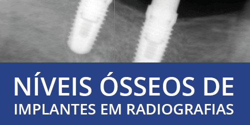 Anatomia da Mandíbula (Com Tabela Resumida do Osso) – Odonto Up