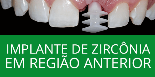 Implante de zircônia em região anterior na manutenção estética em condições desfavoráveis