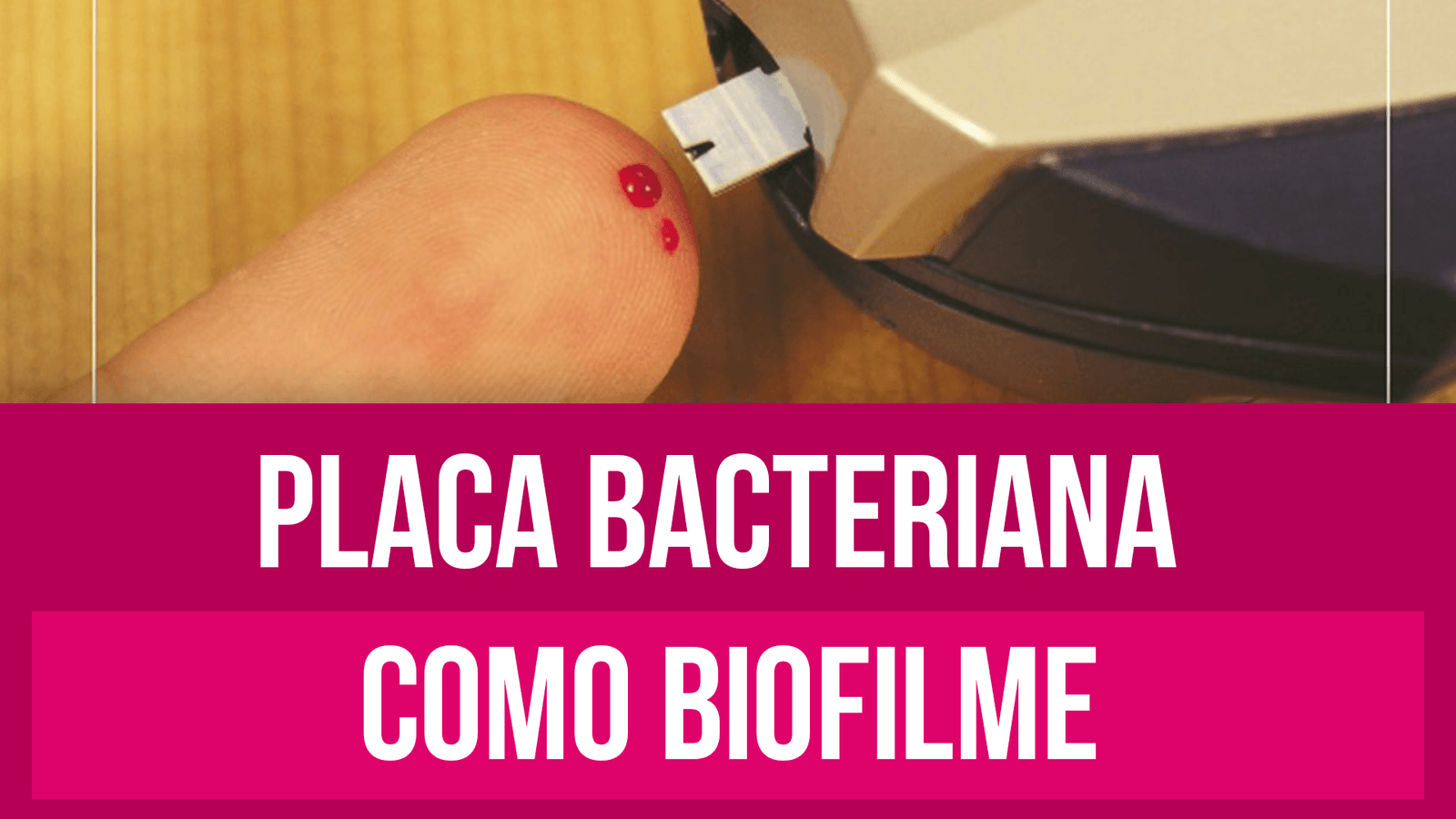 biofilme de placa dentária