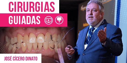 Cirurgias guiadas na Implantodontia – José Cícero Dinato